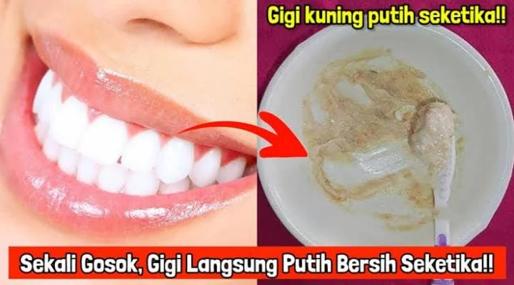 Bersihkan Gigi Lebih Bersih, Ini Tips & Trick Oil Pulling!