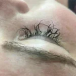 Cara Mengatasi Bulu Mata yang Sering Rontok Akibat Eyelash Extension atau Penjepit Bulu Mata