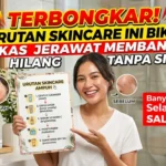 Cara Menghilangkan Bekas Jerawat Merah yang Membandel
