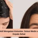 Terungkap! Cara Mengatasi Masalah Kulit Kepala Kering yang Sering Disalahartikan Sebagai Ketombe Biasa