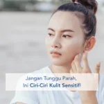 Waspada! Ini Ciri-ciri Kulit Kamu Termasuk Sensitif